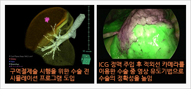 최신 테크닉을 이용한 폐암 수술