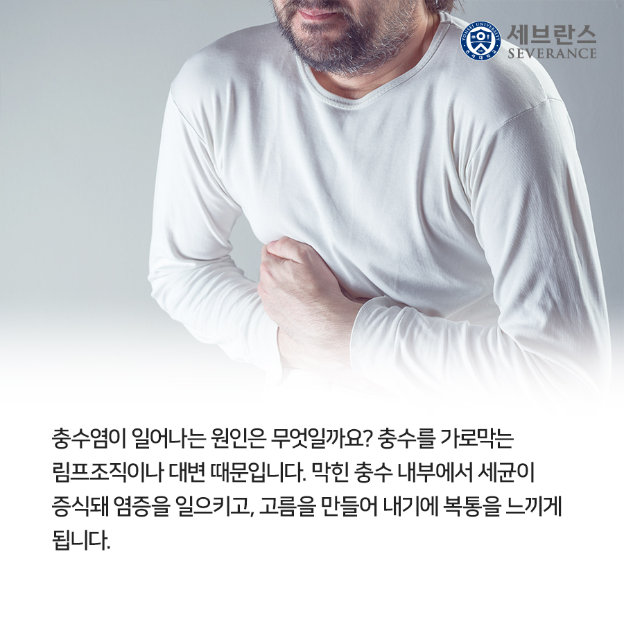  충수염이 일어나는 원인은 무엇일까요? 충수를 가로막는 림프조직이나 대변 때문입니다. 막힌 충수 내부에서 세균이 증식돼 염증을 일으키고, 고름을 만들어 내기에 복통을 느끼게 됩니다. 