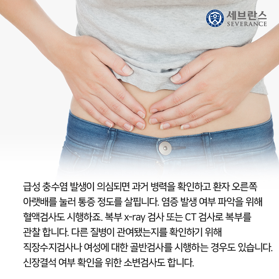 급성 충수염은 10대~30대에서 자주 발생하죠. 충수 내부 염증이 점점 자라나 터져버리면 세균이복부 내부에 번져 복막염으로 확장될 수 있답니다. 복막염을 자칫 생명을 잃을 수 있는  위험한 질환이므로 빠른 치료가 필요합니다.