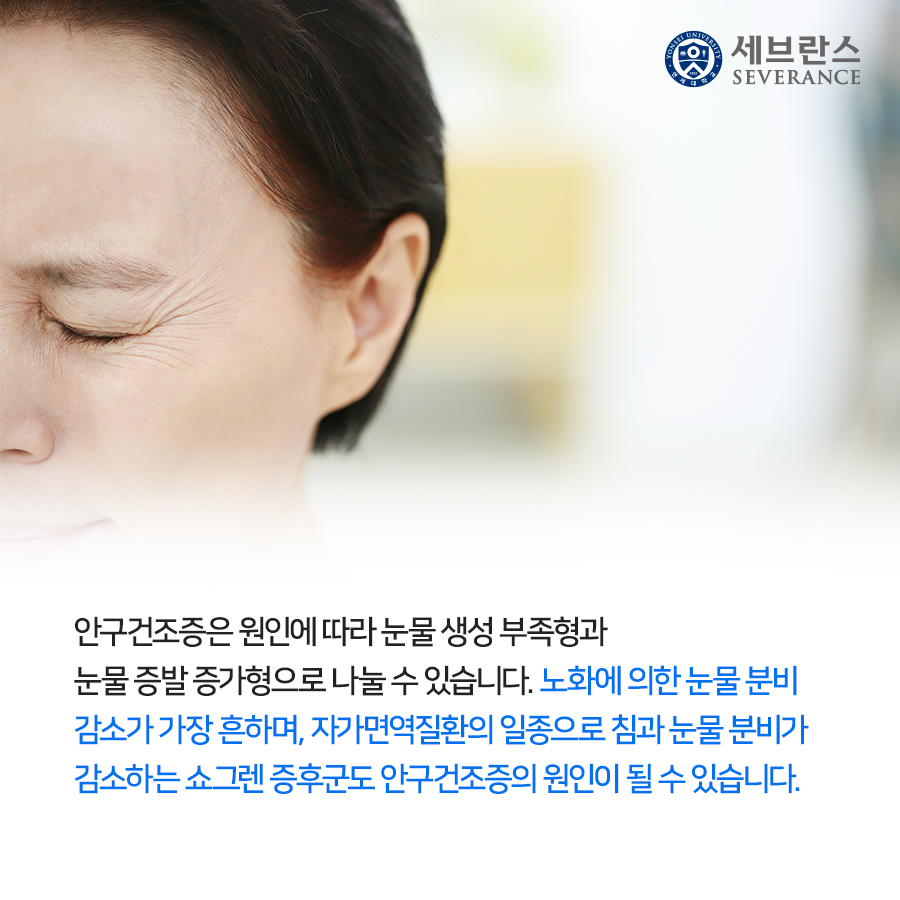 안구건조증은 원인에 따라 눈물 생성 부족형과 눈물 증발 증가형으로 나눌 수 있습니다. 노화에 의한 눈물 분비 감소가 가장 흔하며, 자가면역질환의 일종으로 침과 눈물 분비가 감소하는 쇼그렌 증후군도 안구건조증의 원인이 될 수 있습니다.