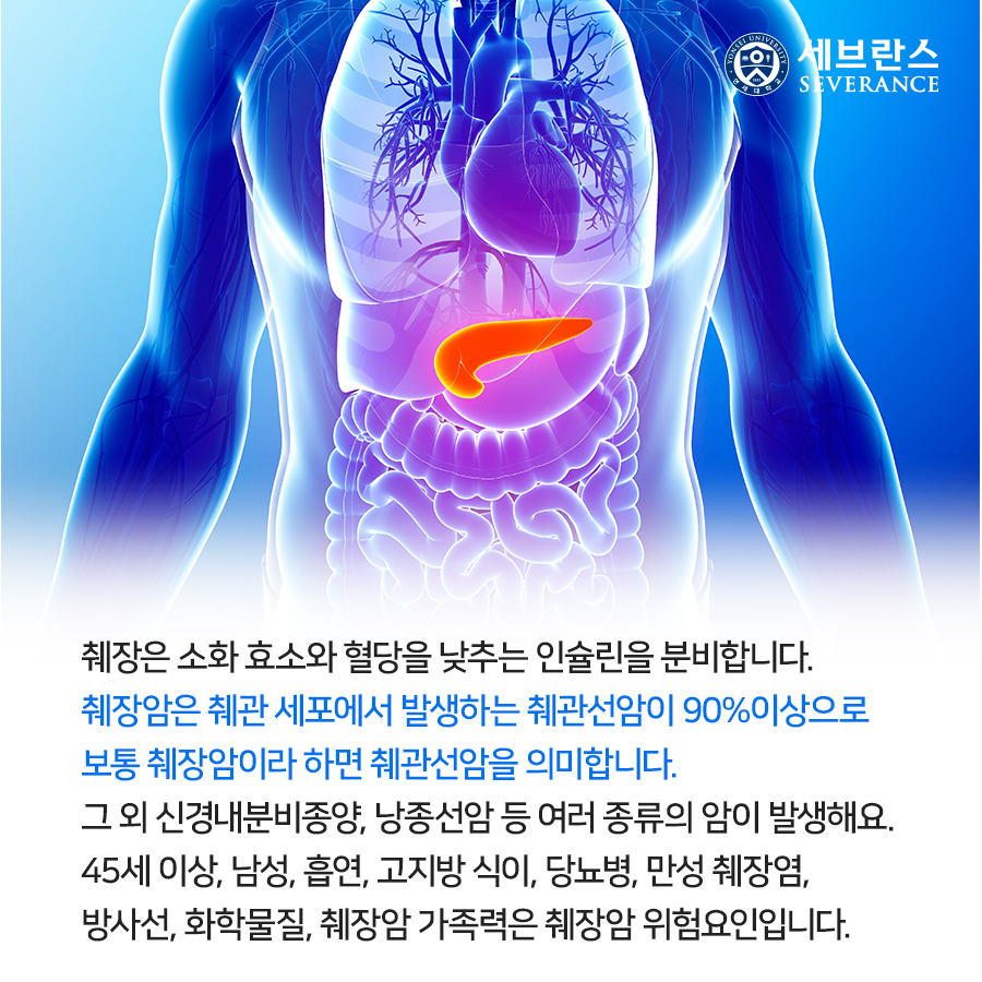 췌장은 소화 효소와 혈당을 낮추는 인슐린을 분비합니다. 췌장암은 췌관 세포에서 발생하는 췌관선암이 90%이상으로 보통 췌장암이라 하면 췌관선암을 의미합니다.  그 외 신경내분비종양, 낭종선암 등 여러 종류의 암이 발생해요. 45세 이상, 남성, 흡연, 고지방 식이, 당뇨병, 만성 췌장염, 방사선, 화학물질, 췌장암 가족력은 췌장암 위험요인입니다. 