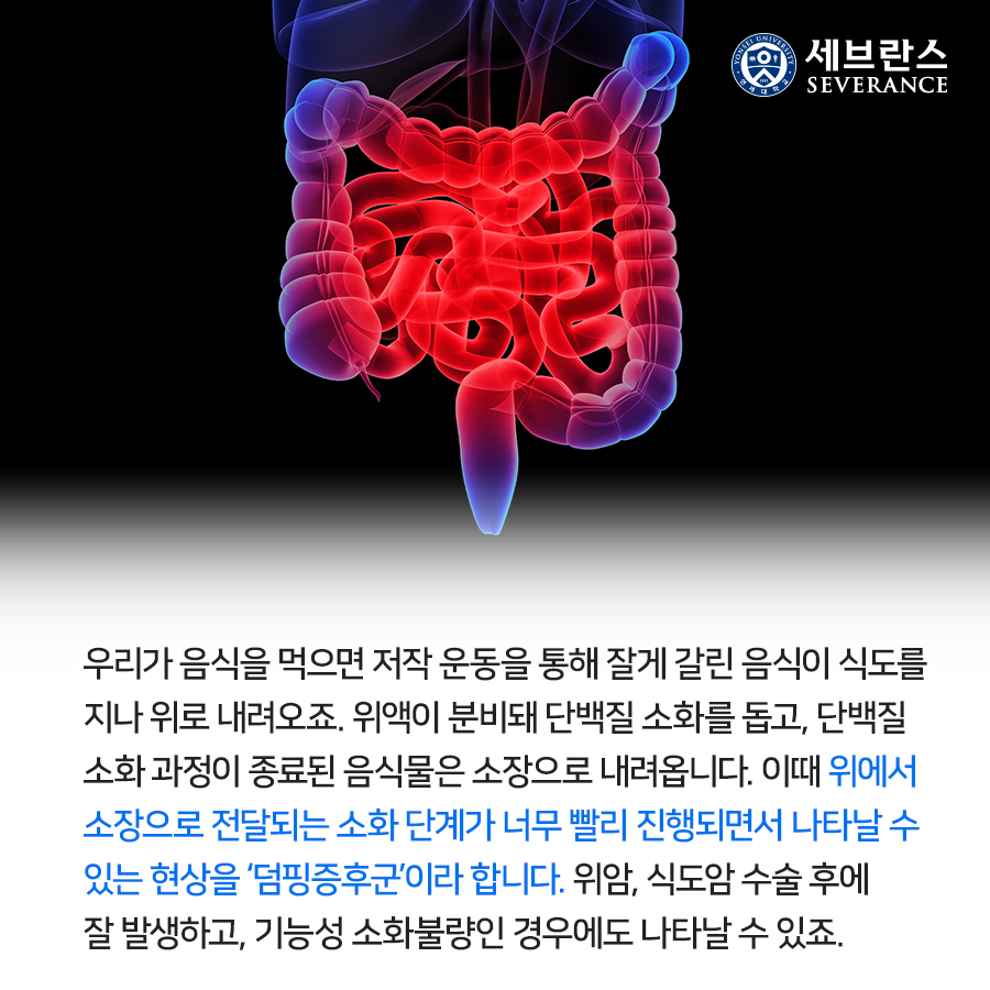 우리가 음식을 먹으면 저작 운동을 통해 잘게 갈린 음식이 식도를 지나 위로 내려오죠. 위액이 분비돼 단백질 소화를 돕고, 단백질 소화 과정이 종료된 음식물은 소장으로 내려옵니다.  이때 위에서 소장으로 전달되는 소화 단계가 너무 빨리 진행되면서 나타날 수 있는 현상을 ‘덤핑증후군’이라 합니다. 위암, 식도암 수술 후에 잘 발생하고, 기능성 소화불량인 경우에도 나타날 수 있죠.