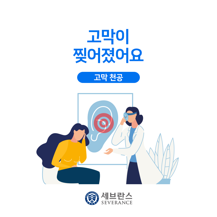 고막이 찢어졌어요. 고막 천공