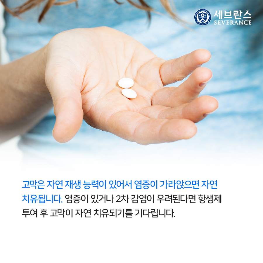 고막은 자연 재생 능력이 있어서 염증이 가라앉으면 자연 치유됩니다. 염증이 있거나 2차 감염이 우려된다면 항생제 투여 후 고막이 자연 치유되기를 기다립니다. 