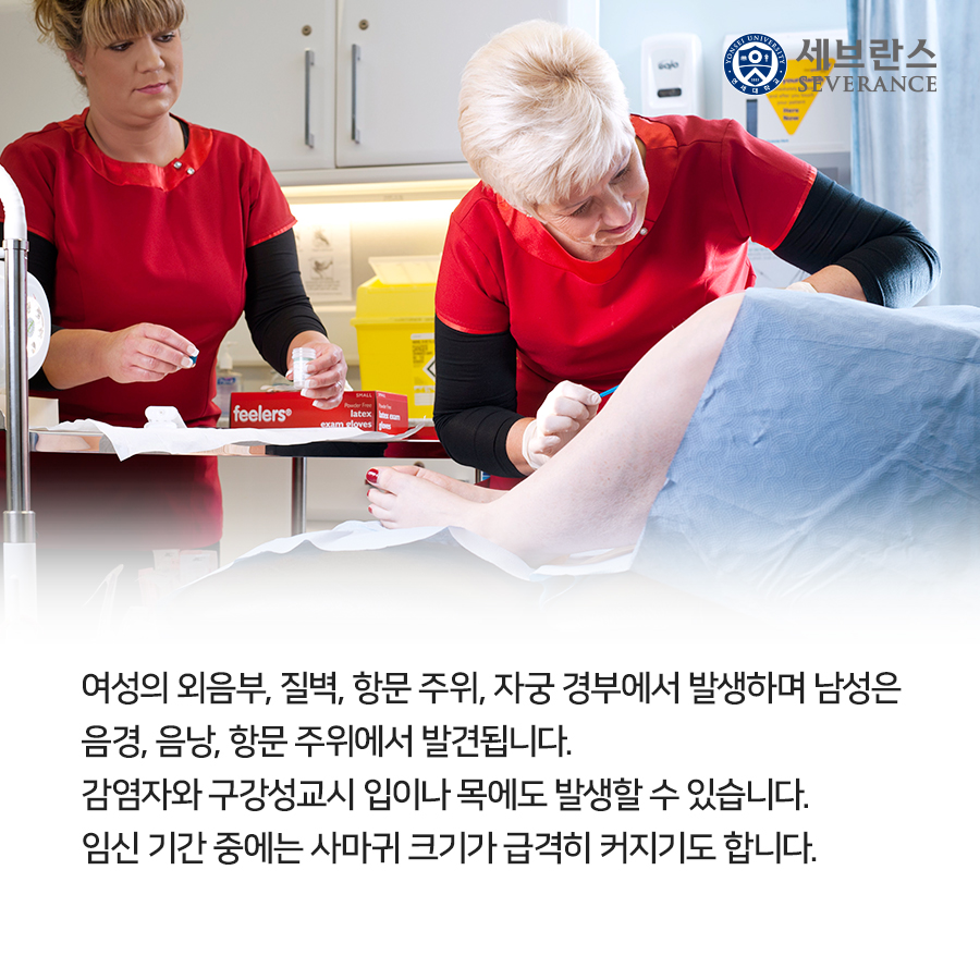 여성의 외음부, 질벽, 항문 주위, 자궁 경부에서 발생하며 남성은 음경, 음낭, 항문 주위에서 발견됩니다.  감염자와 구강성교시 입이나 목에도 발생할 수 있습니다.  임신 기간 중에는 사마귀 크기가 급격히 커지기도 합니다.