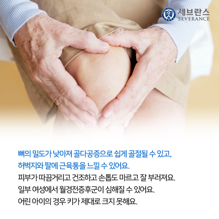뼈의 밀도가 낮아져 골다공증으로 쉽게 골절될 수 있고,  허벅지와 팔에 근육통을 느낄 수 있어요.  피부가 따끔거리고 건조하고 손톱도 마르고 잘 부러져요.  일부 여성에서 월경전증후군이 심해질 수 있어요.  어린 아이의 경우 키가 제대로 크지 못해요.