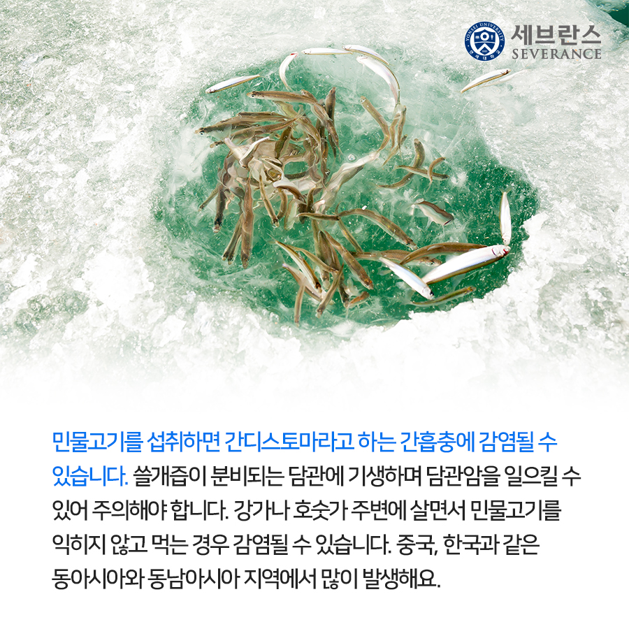 민물고기를 섭취하면 간디스토마라고 하는 간흡충에 감염될 수 있습니다. 쓸개즙이 분비되는 담관에 기생하며 담관암을 일으킬 수 있어 주의해야 합니다. 강가나 호숫가 주변에 살면서 민물고기를 익히지 않고 먹는 경우 감염될 수 있습니다. 중국, 한국과 같은 동아시아와 동남아시아 지역에서 많이 발생해요.