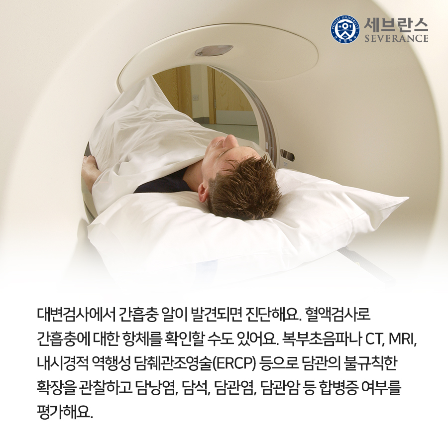 대변검사에서 간흡충 알이 발견되면 진단해요. 혈액검사로 간흡충에 대한 항체를 확인할 수도 있어요. 복부초음파나 CT, MRI, 내시경적 역행성 담췌관조영술(ERCP) 등으로 담관의 불규칙한 확장을 관찰하고 담낭염, 담석, 담관염, 담관암 등 합병증 여부를 평가해요.