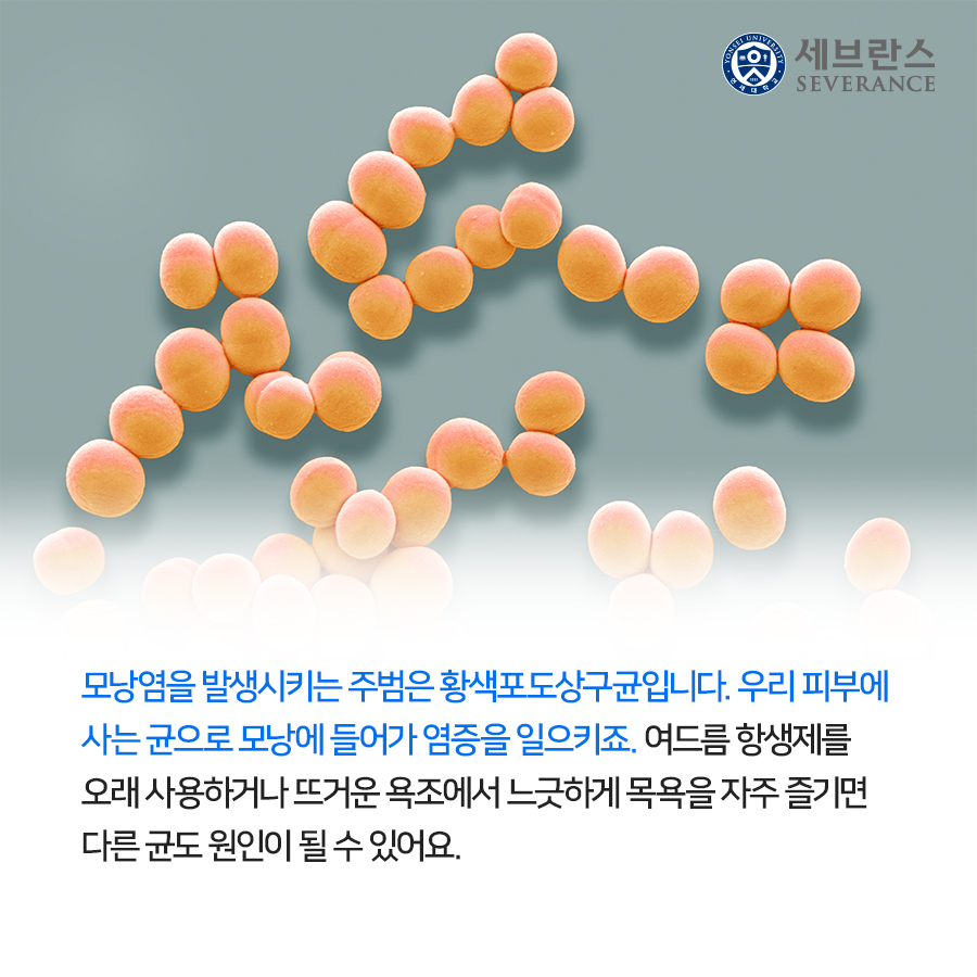 모낭염을 발생시키는 주범은 황색포도상구균입니다. 우리 피부에 사는 균으로 모낭에 들어가 염증을 일으키죠. 여드름 항생제를 오래 사용하거나 뜨거운 욕조에서 느긋하게 목욕을 자주 즐기면 다른 균도 원인이 될 수 있어요.