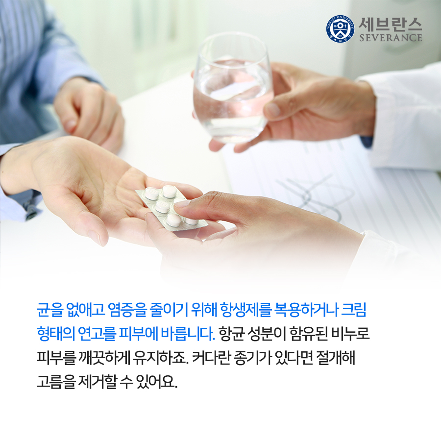 균을 없애고 염증을 줄이기 위해 항생제를 복용하거나 크림 형태의 연고를 피부에 바릅니다. 항균 성분이 함유된 비누로 피부를 깨끗하게 유지하죠. 커다란 종기가 있다면 절개해 고름을 제거할 수 있어요.