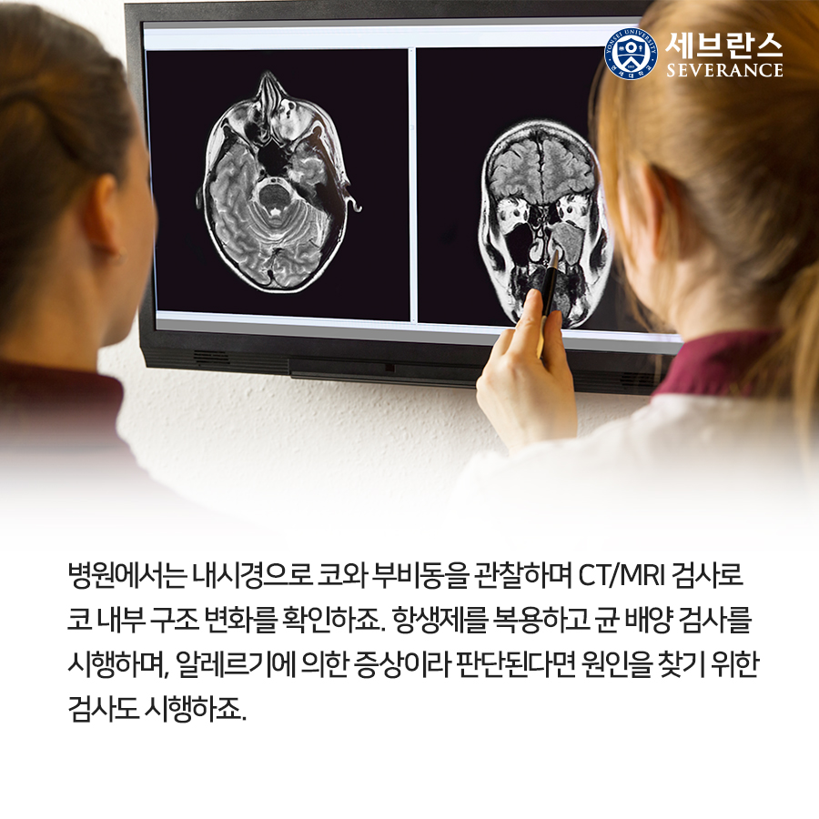 병원에서는 내시경으로 코와 부비동을 관찰하며 CT/MRI 검사로 코 내부 구조 변화를 확인하죠. 항생제를 복용하고 균 배양 검사를 시행하며, 알레르기에 의한 증상이라 판단된다면 원인을 찾기 위한 검사도 시행하죠.