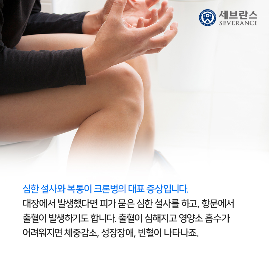 심한 설사와 복통이 크론병의 대표 증상입니다.  대장에서 발생했다면 피가 묻은 심한 설사를 하고, 항문에서  출혈이 발생하기도 합니다. 출혈이 심해지고 영양소 흡수가  어려워지면 체중감소, 성장장애, 빈혈이 나타나죠.