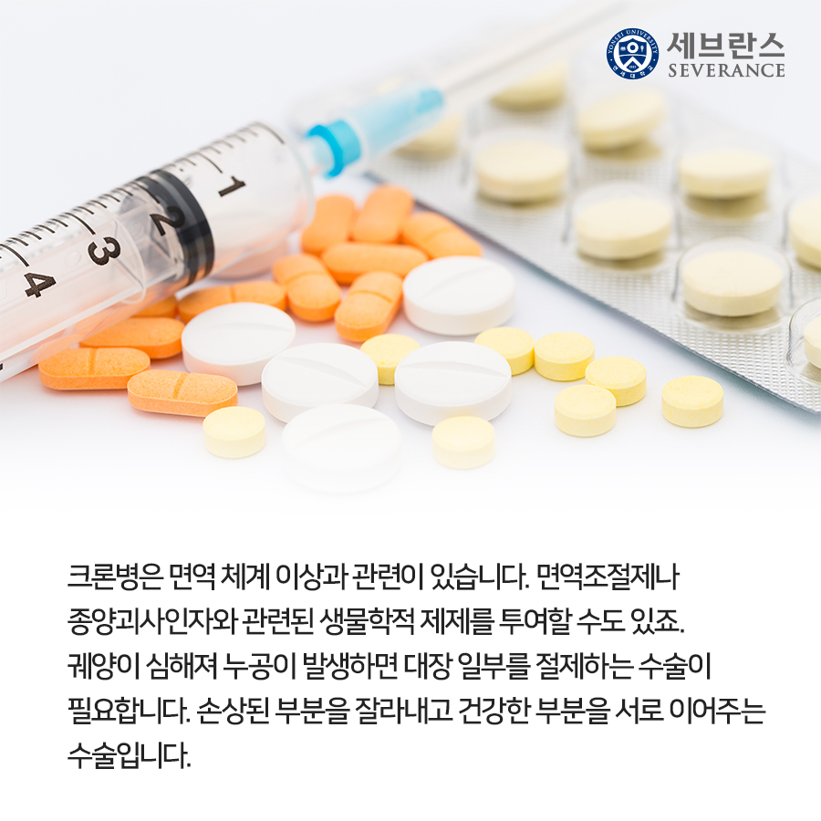 크론병은 면역 체계 이상과 관련이 있습니다. 면역조절제나  종양괴사인자와 관련된 생물학적 제제를 투여할 수도 있죠. 궤양이 심해져 누공이 발생하면 대장 일부를 절제하는 수술이  필요합니다. 손상된 부분을 잘라내고 건강한 부분을 서로 이어주는  수술입니다.
