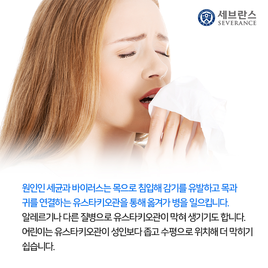 원인인 세균과 바이러스는 목으로 침입해 감기를 유발하고 목과 귀를 연결하는 유스타키오관을 통해 옮겨가 병을 일으킵니다. 알레르기나 다른 질병으로 유스타키오관이 막혀 생기기도 합니다. 어린이는 유스타키오관이 성인보다 좁고 수평으로 위치해 더 막히기 쉽습니다.