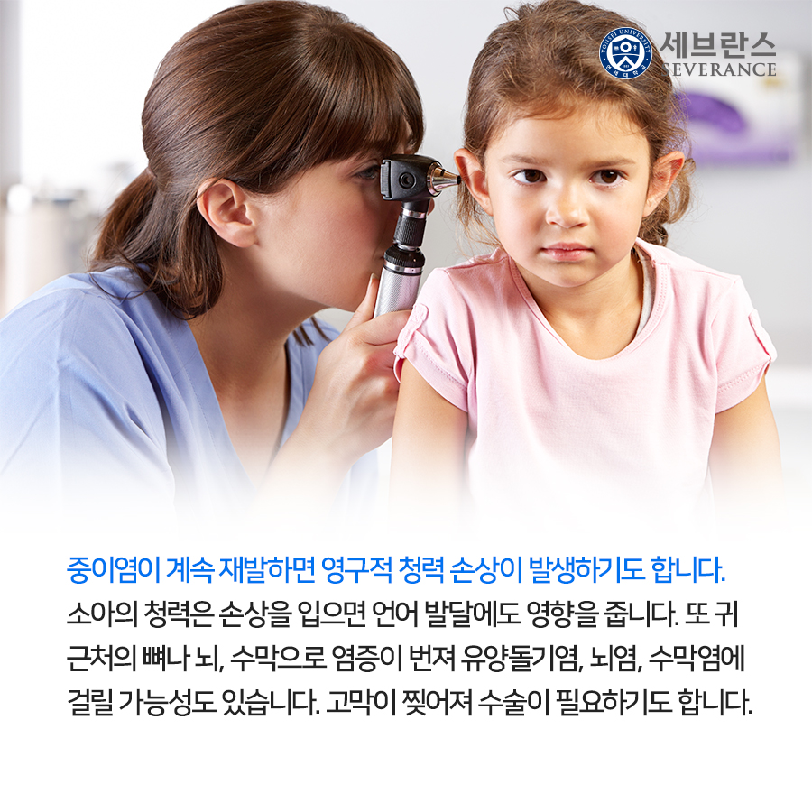 중이염이 계속 재발하면 영구적 청력 손상이 발생하기도 합니다. 소아의 청력은 손상을 입으면 언어 발달에도 영향을 줍니다. 또 귀 근처의 뼈나 뇌, 수막으로 염증이 번져 유양돌기염, 뇌염, 수막염에 걸릴 가능성도 있습니다. 고막이 찢어져 수술이 필요하기도 합니다.