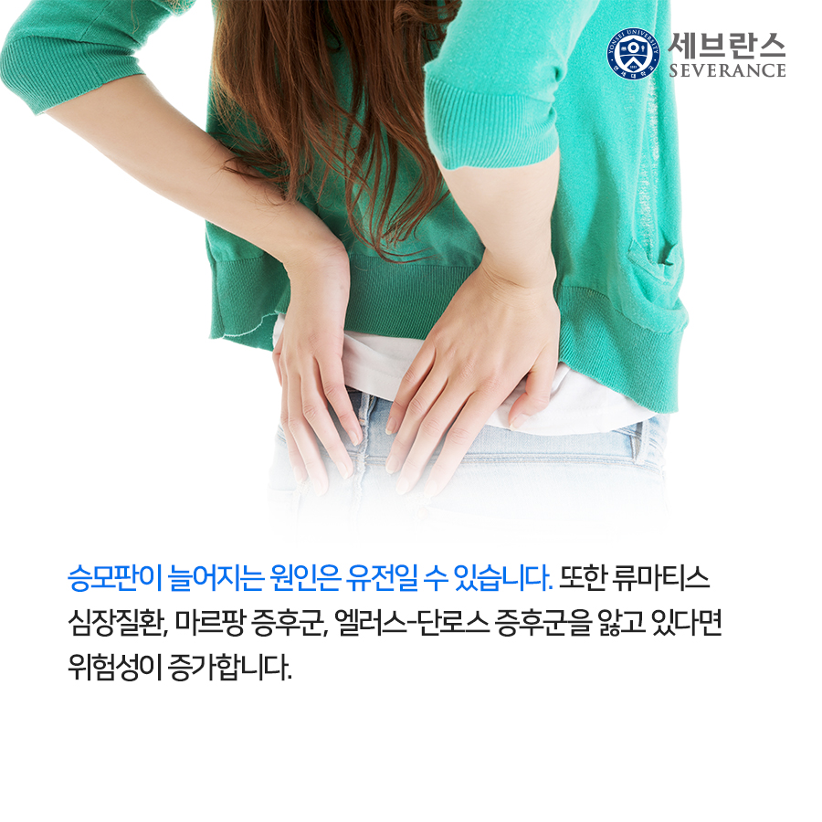 승모판이 늘어지는 원인은 유전일 수 있습니다. 또한 류마티스 심장질환, 마르팡 증후군, 엘러스-단로스 증후군을 앓고 있다면 위험성이 증가합니다.