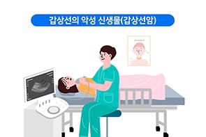 갑상선암