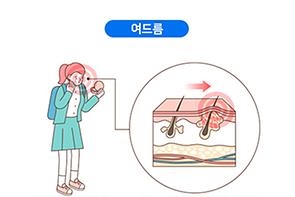여드름