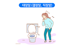 대장암