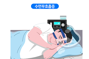 수면무호흡증