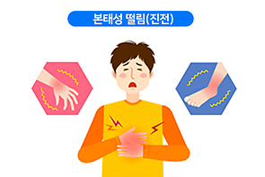 본태성 떨림(진전)