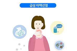 급성 타액선염