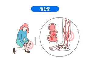 혈관종