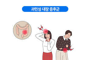 과민성 대장 증후군