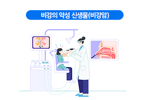비강의 악성 신생물(비강암)