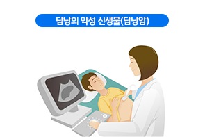 담낭암