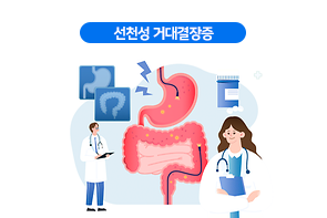 선천성 거대결장증