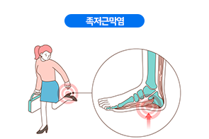 족저근막염