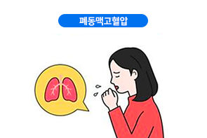폐동맥고혈압
