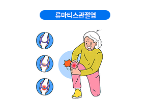 류마티스관절염