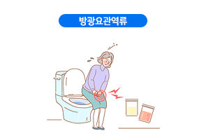 방광요관역류