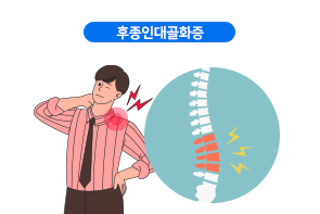 후종인대골화증