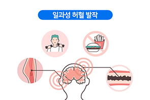 일과성 허혈 발작