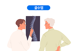골수염
